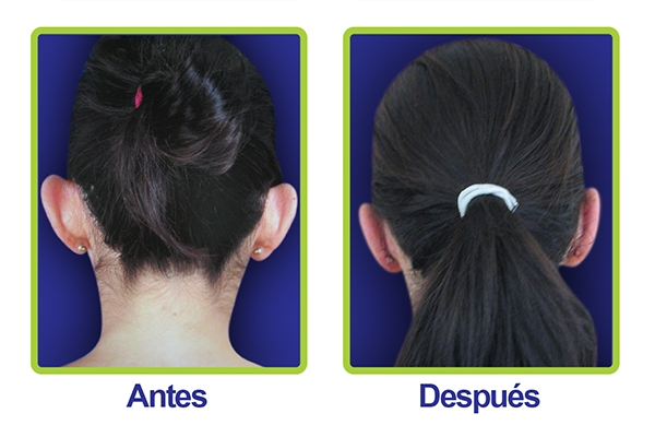 orejas1