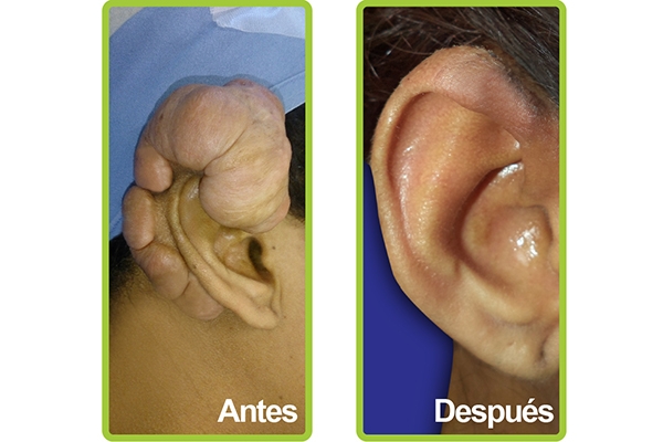 orejas2