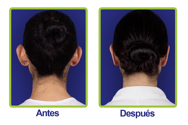 orejas3